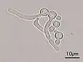 Germ tubes of Candida albicans