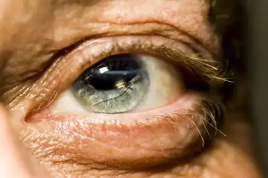 Wise Eyes