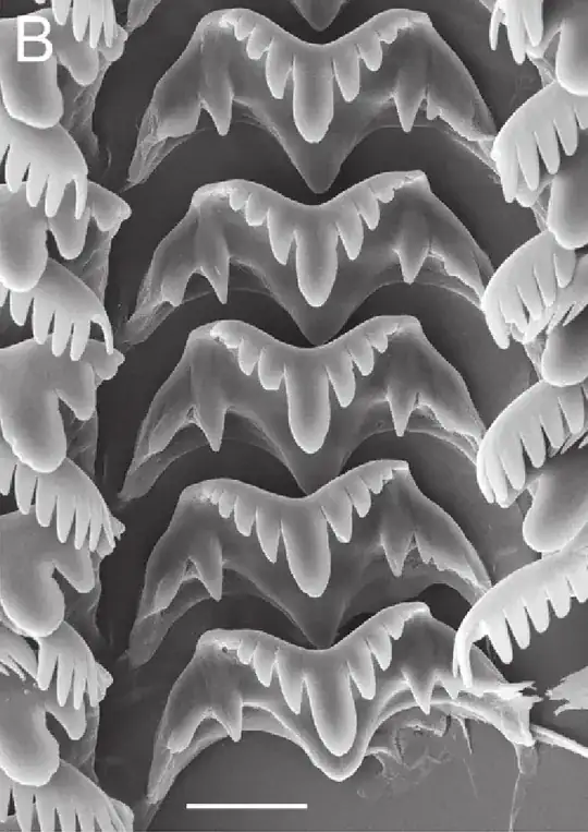 A picture of some snail's radular teeth