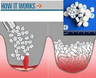 XStat illustration